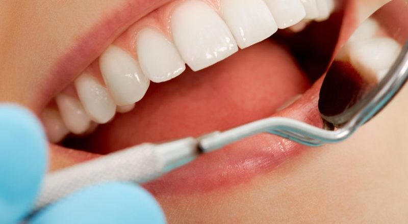 Se você é de Brasília, Águas Claras, Vicente Pires e Ceilândia venha fazer sua avaliação para implante dentário, lente de contato dental e aparelho ortodontico na Rame Odontologia em Taguatinga pelo Telefone (61) 3965-1880. Recupere a sua vontade de sorrir! Somos especialista em implantes dentários em Taguatinga desde 2004.