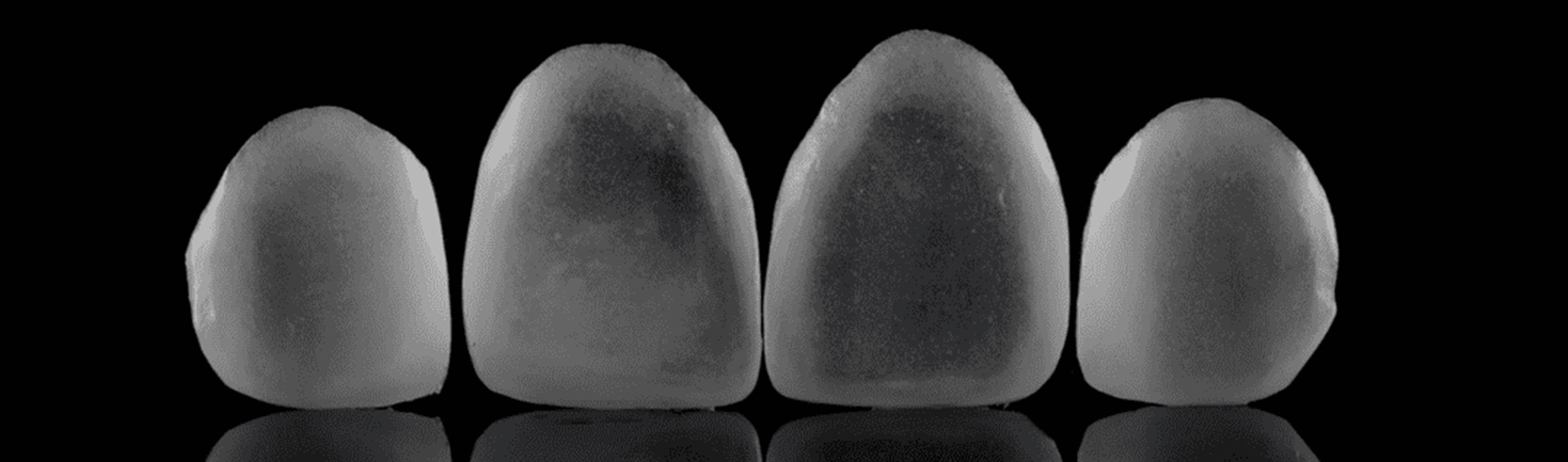 Lentes de Contato Dental em Taguatinga. O Tratamento estético odontológico com lentes de contato dental são capazes de transformar completamente o seu sorriso em poucos dias. Conheça o diferencial da Rame em Taguatinga