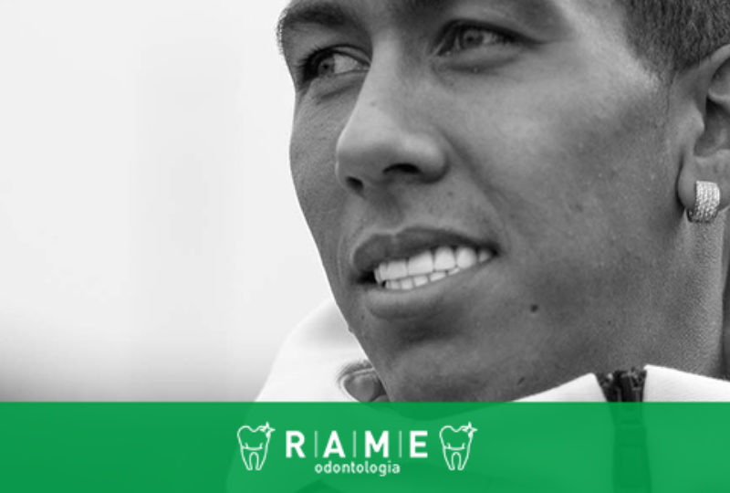 As lentes de contato dental e o sorriso de Roberto Firmino da Seleção Brasileira